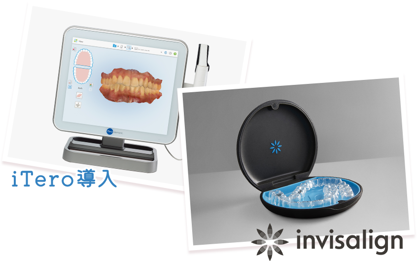 iTero導入 invisalign