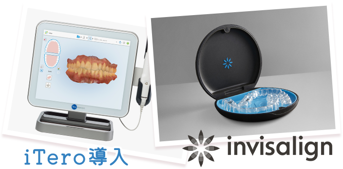 iTero導入 invisalign
